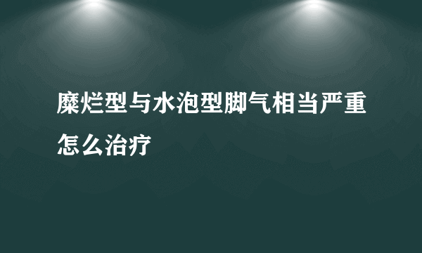 糜烂型与水泡型脚气相当严重怎么治疗