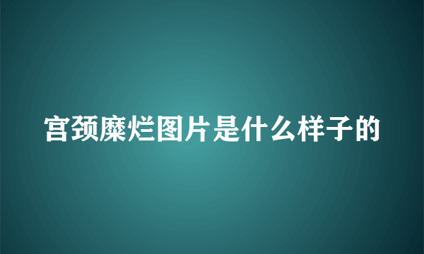 宫颈糜烂图片是什么样子的