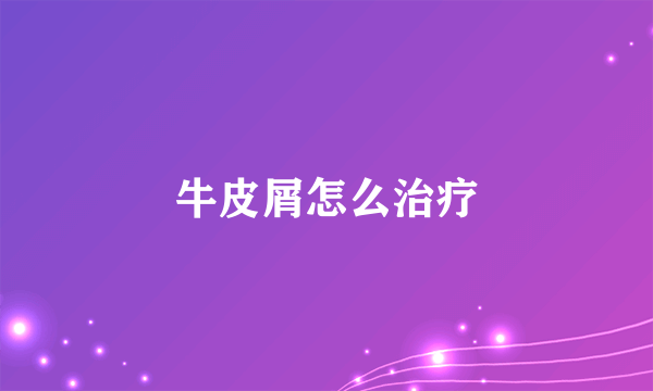 牛皮屑怎么治疗