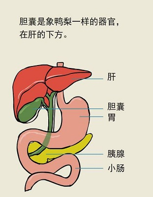 胆囊息肉怎么才能消除？