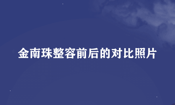 金南珠整容前后的对比照片