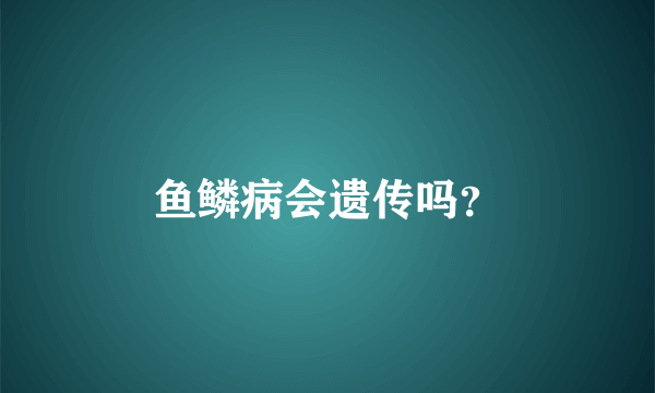 鱼鳞病会遗传吗？